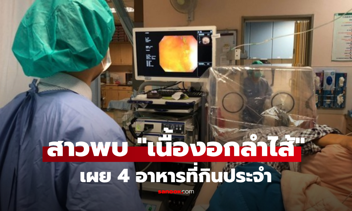 สาววัย 30 ตรวจพบ "เนื้องอกลำไส้" แพทย์เตือนชาวออฟฟิศกิน 4 อย่างนี้ประจำ ระวัง!