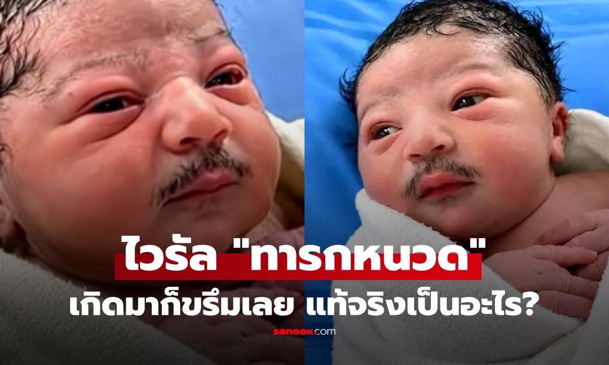 ไวรัล 44 ล้าน! "ทารกหนวด" ชาวเน็ตแซวเกิดมาก็ขรึมเลย เฉลยแล้วน้องเป็นอะไร?