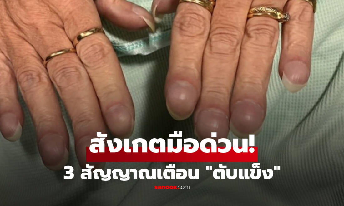 สังเกตมือด่วน! 3 สัญญาณเตือน "โรคตับแข็ง" ที่หลายคนมองข้าม