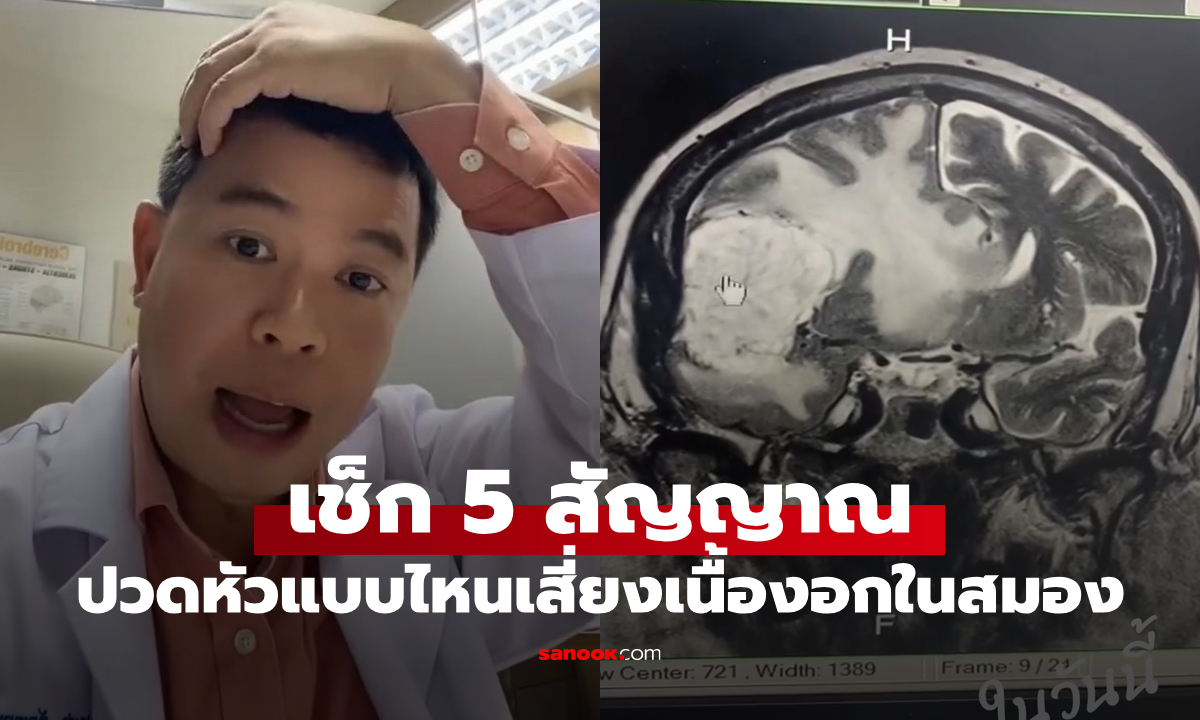 เช็ก 6 สัญญาณ ปวดหัวแบบไหนเสี่ยง "เนื้องอกในสมอง" หมอประชายกเคสเตือน