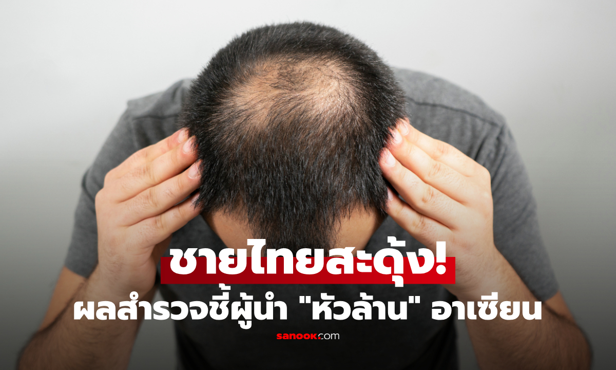 ชายไทยสะดุ้ง! ติดโผผู้นำ "หัวล้าน" ในอาเซียน แล้วทั่วโลกอยู่ที่เท่าไหร่?