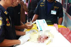 ทารกถูกจีสตริงฆ่ารัดคอ ทิ้งถังขยะสนามบิน