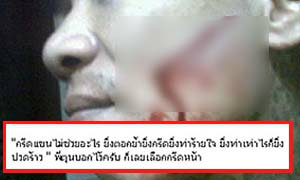 หนุ่มกรีดหน้าขอโทษแฟนผ่านเฟซบุ๊ก ชาวเน็ตจวกยับ