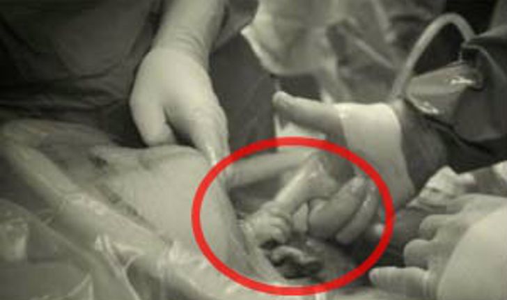 ภาพมหัศจรรย์ของชีวิต "ทารกจับมือคุณหมอขณะคลอด" ถูกแชร์ทั่วออนไลน์