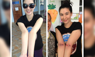 วิจารณ์หนัก! 'ตบแขนล้างพิษ' ของ คุณหนูดี