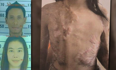 ไร้วี่แวว 2 ผัวเมียราดน้ำร้อนใส่เด็ก ตั้งค่าหัว 1 แสน