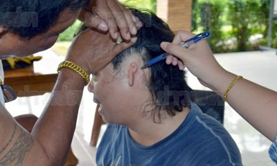 ส.ท.หนุ่มสามพราน ไม่มีใบหู-รูหูทั้ง 2 ข้าง