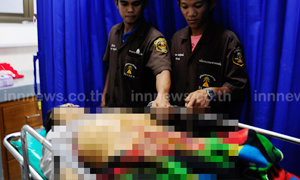 ช่างไม้โดนเลื่อยวงเดือนตัดท้องไส้ทะลักดับ