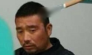 อึ้ง! หนุ่มมีดปักหัว เดินมาหาหมอหน้าเรียบเฉย