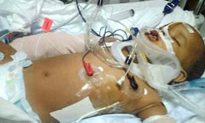 หนูน้อยมหัศจรรย์รอดชีวิตจากตกตึกชั้น 11 ในสหรัฐ