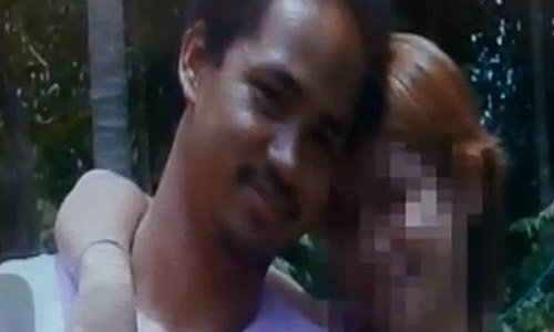 สามีใหม่สาดน้ำกรดใส่ภรรยา-ลูกเลี้ยง 3 ขวบ นครศรีฯ สาหัส