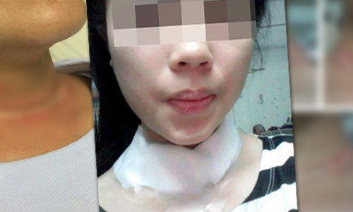 โผล่อีกราย สาวขี่ จยย.โดนบาดคอ ภัยเงียบเล่นว่าว