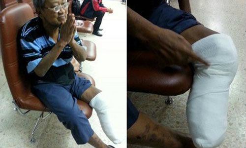 คนไข้ถูกตัดขาโวย โรงพยาบาลดังพาทิ้งโรงพัก