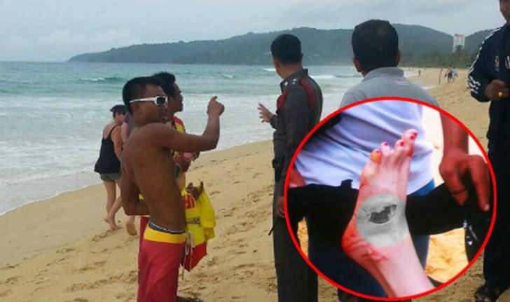 นักท่องเที่ยวเล่นน้ำหาดกะรนถูกสัตว์กัดเท้า จนท.คาดเป็นฉลาม