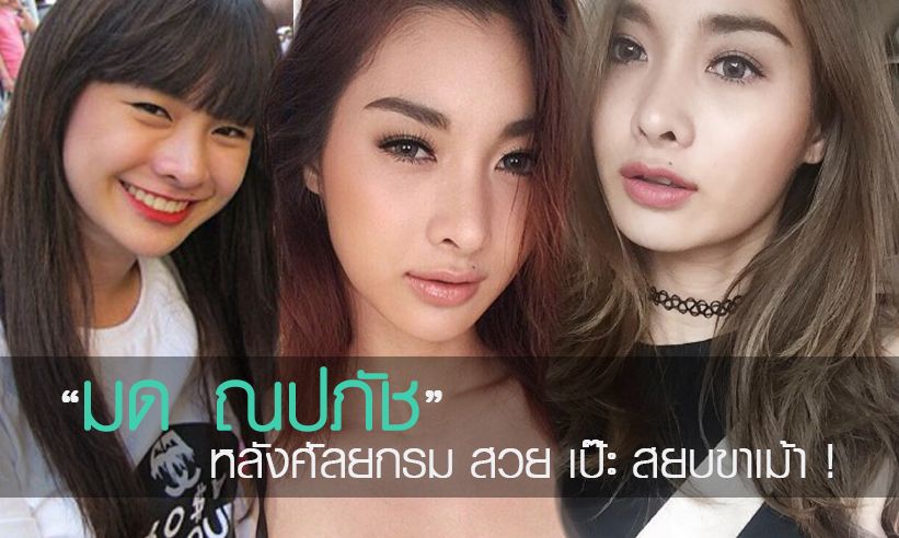 "มด ณปภัช" งานเข้าเพียบ ! หลังศัลยกรรมหน้าเข้าที่ สวยสยบ ตบหน้าขาเม้า !