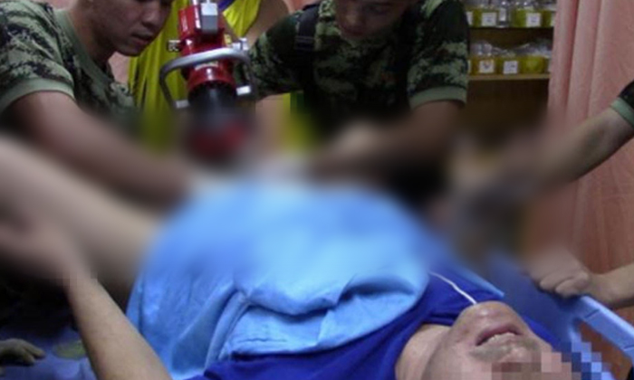 หนุ่มใหญ่ถูกแม่เหล็กหนีบอัณฑะ เจ็บทรมานกว่า 4 ชั่วโมง