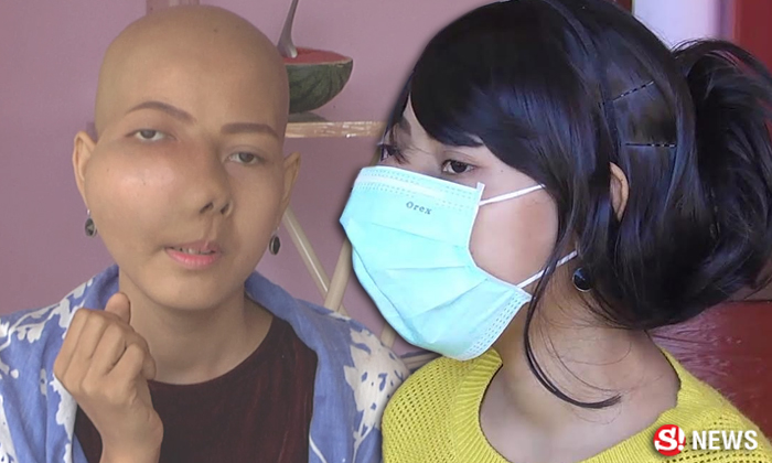 เปิดใจ "เจนี่" สาวมะเร็งขึ้นใบหน้า ที่ชาวเน็ตต่างส่งกำลังใจ