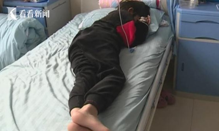ครูจีนโหดตีทำโทษเด็กหญิง 9 ขวบก้นช้ำต้องนอนรพ. เหตุเพราะทำการบ้านไม่เสร็จ