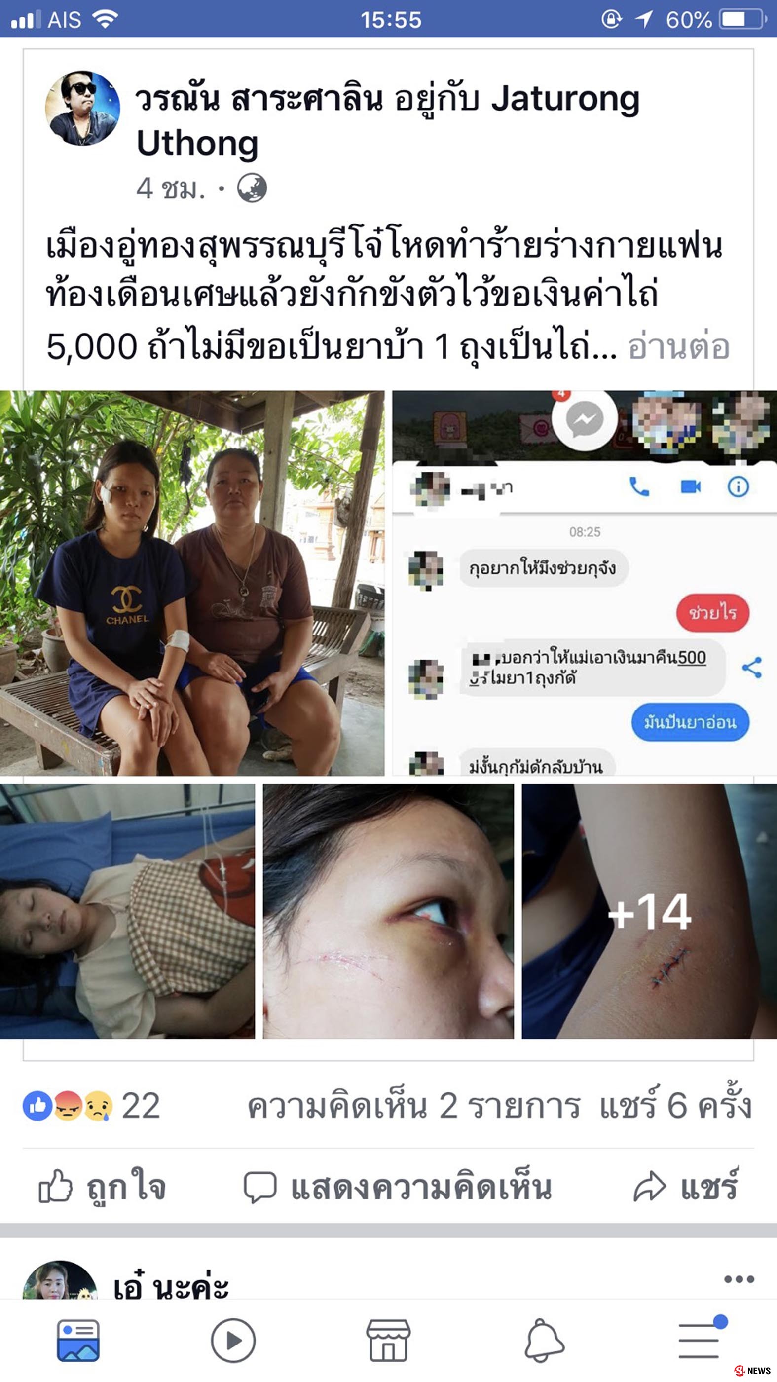 จับผัวอำมหิต! ทาสยาบ้าเสพวันละ 10 เม็ด หลอนจัดทุบตี-มีดกรีดหน้าแฟนสาวทั้งที่ตั้งครรภ์