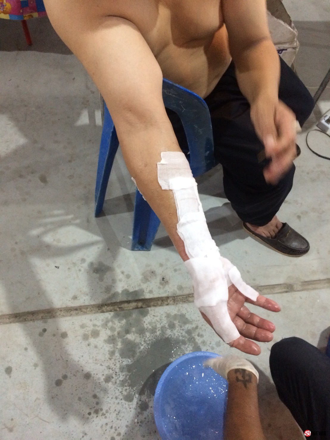 ชายมือที่สาม-ก่อเหตุน้ำมันราดแขนแม่ค้าลูกชิ้นก่อนจุดไฟเผา สามีปรี่เข้ามาช่วยเจ็บอีกคน  