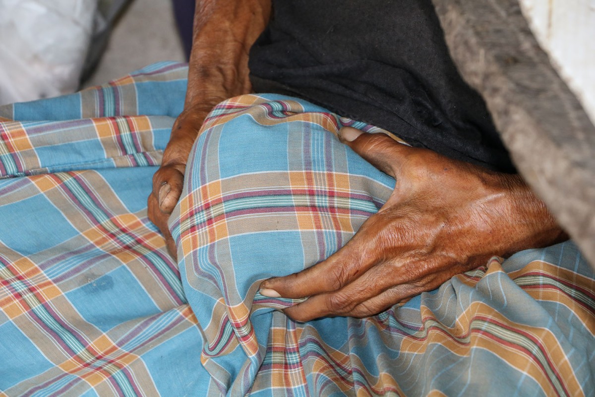 ราชบุรี 01 (สิริมงคล) ส่ง - ลุงวัย 60 ปีสุดทรมานป่วยอัณฑะบวมใหญ่เท่าลูกมะพร้าววอนแพทย์ช่วย