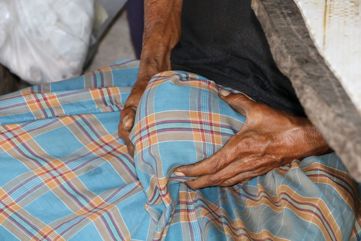 ราชบุรี 01 (สิริมงคล) ส่ง - ลุงวัย 60 ปีสุดทรมานป่วยอัณฑะบวมใหญ่เท่าลูกมะพร้าววอนแพทย์ช่วย