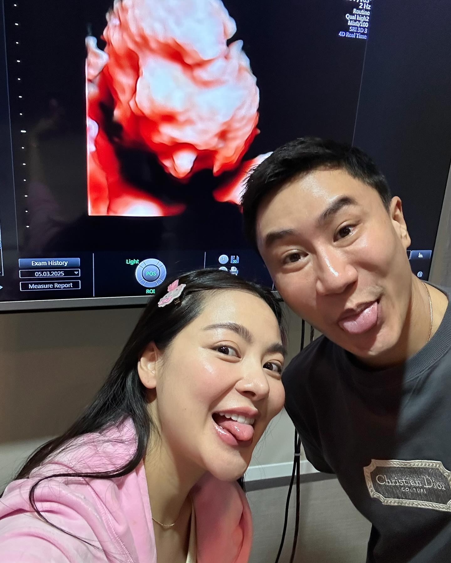 พราวฟ้า เสี่ยโบ๊ท