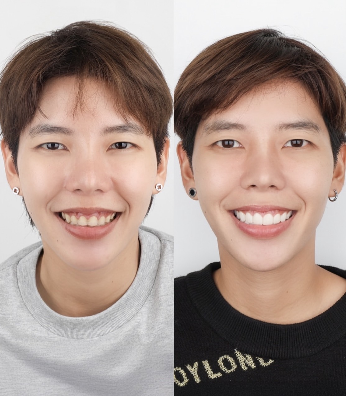 ป๊ายปาย