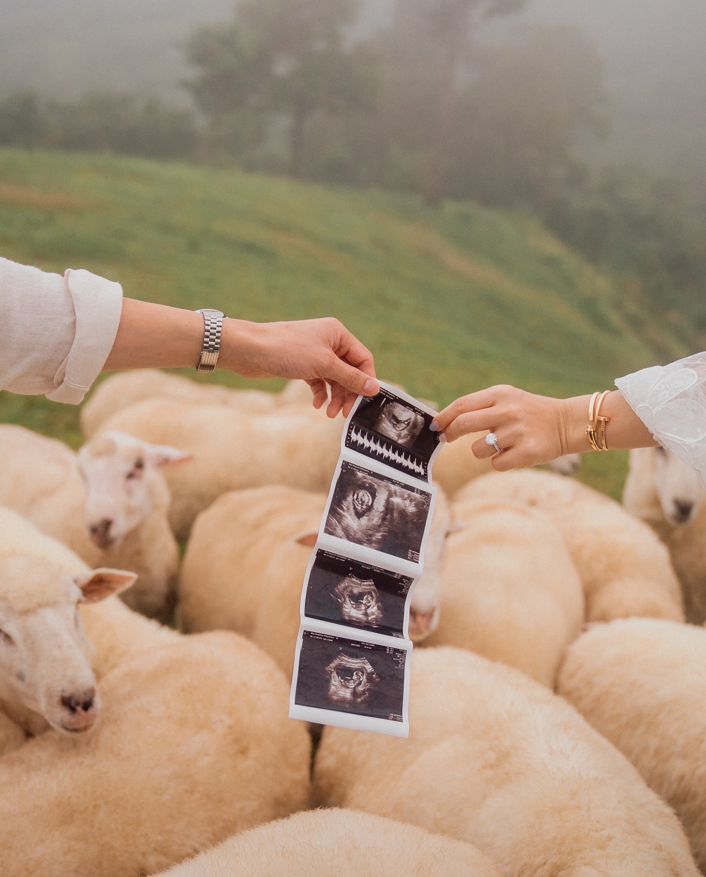 เจมส์ จิรายุ - โฟม เบ็ญจมาส