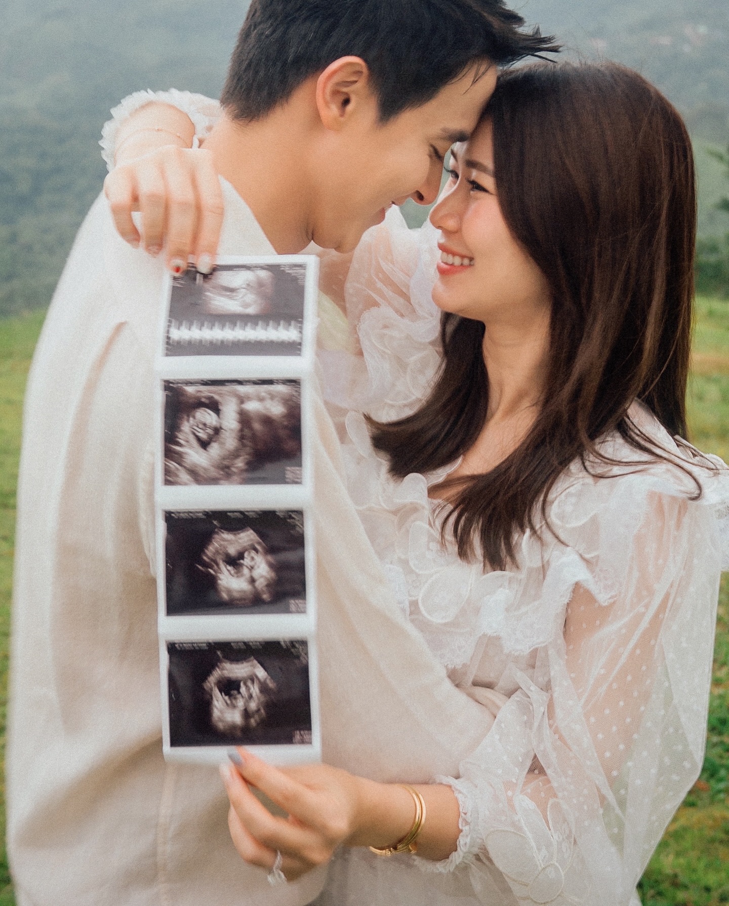 เจมส์ จิรายุ - โฟม เบ็ญจมาส