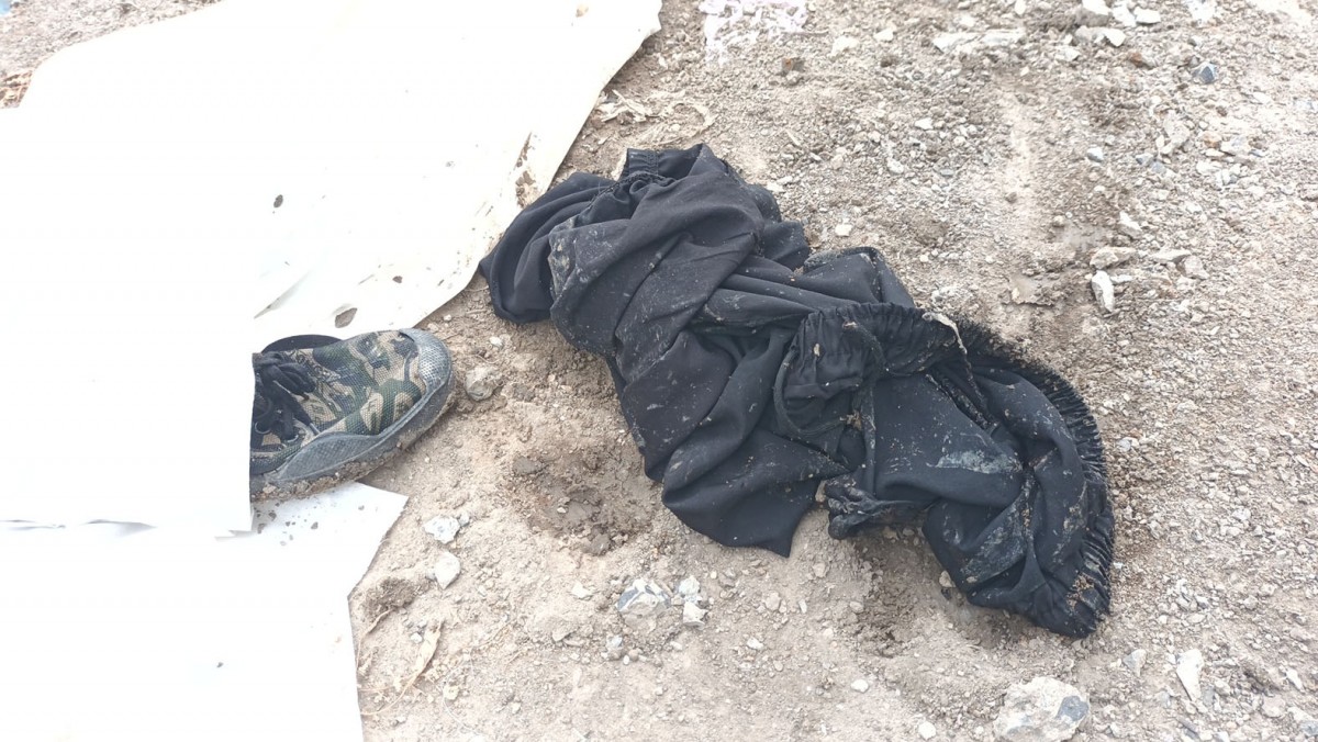 หนุ่มวัย 33 ฉีดแอลกอฮอล์ล้างมือก่อนจุดไฟจะดูดบุหรี่ ไฟลุกติดตามตัวเจ็บ