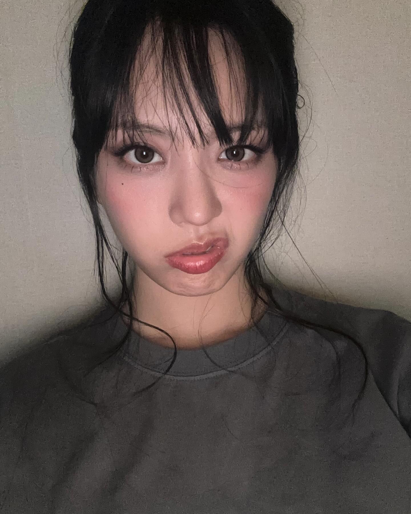 ช็อก! อดีตไอดอล K-POP เปิดใจป่วยมะเร็งเม็ดเลือดขาว