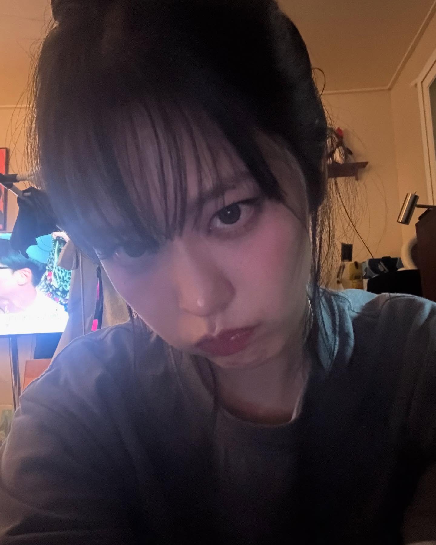 ช็อก! อดีตไอดอล K-POP เปิดใจป่วยมะเร็งเม็ดเลือดขาว