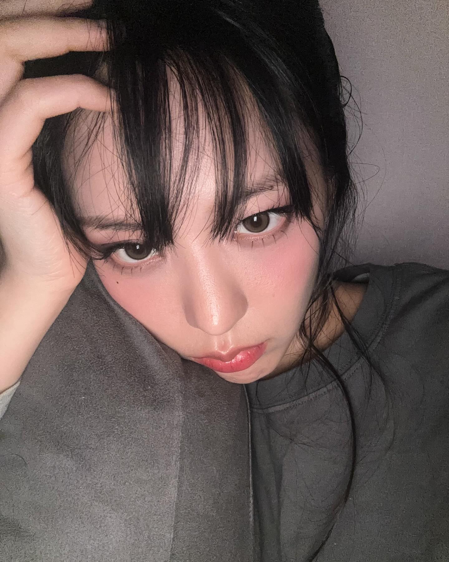 ช็อก! อดีตไอดอล K-POP เปิดใจป่วยมะเร็งเม็ดเลือดขาว