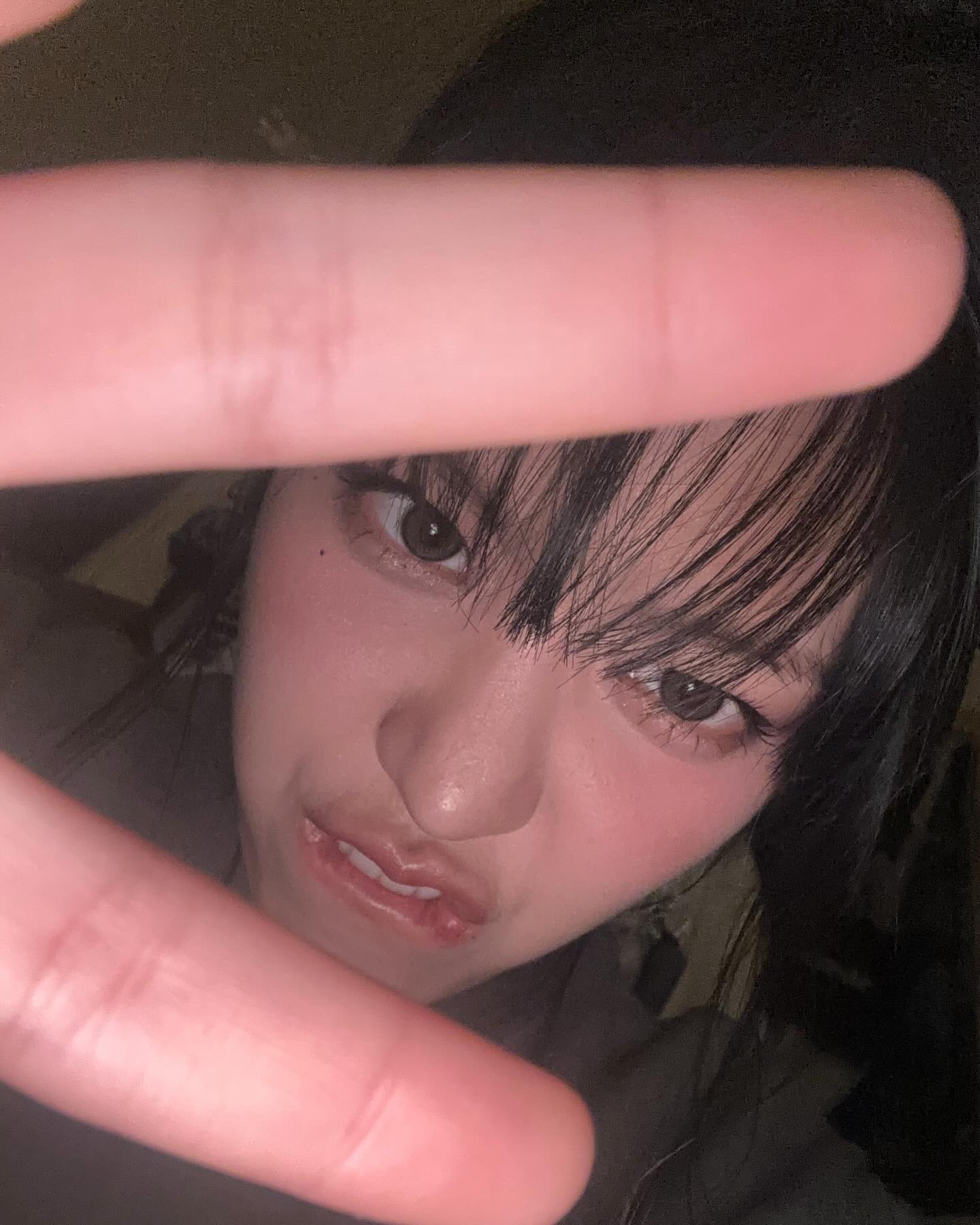 ช็อก! อดีตไอดอล K-POP เปิดใจป่วยมะเร็งเม็ดเลือดขาว