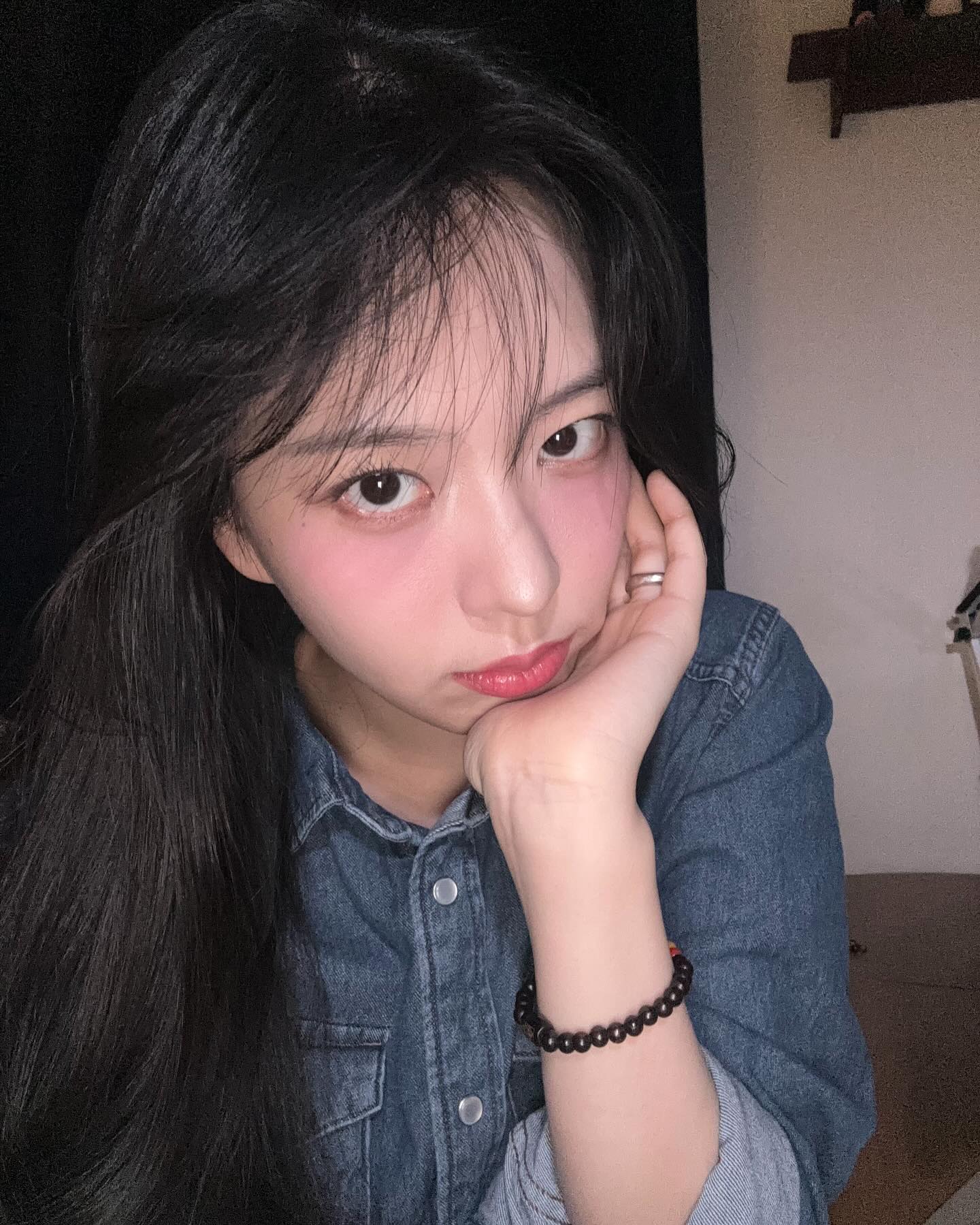 ช็อก! อดีตไอดอล K-POP เปิดใจป่วยมะเร็งเม็ดเลือดขาว