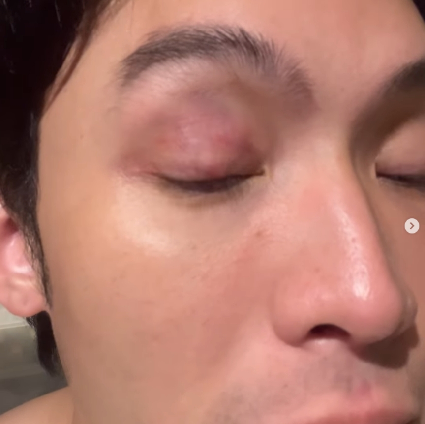 ดีเจมะตูม