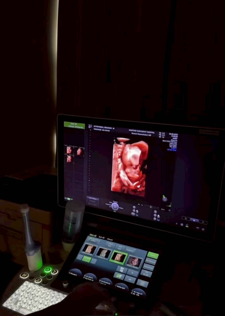 เจมส์ จิรายุ