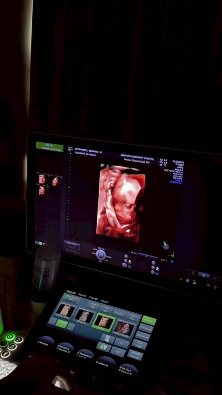 เจมส์ จิรายุ