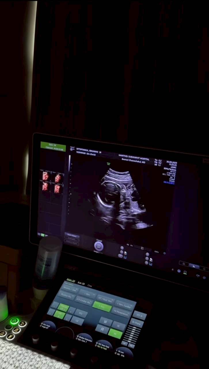 เจมส์ จิรายุ