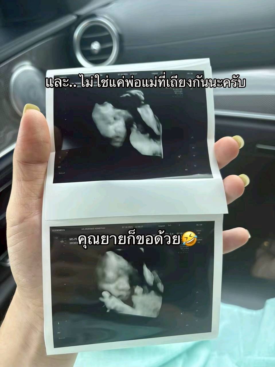 แมท ภีรนีย์