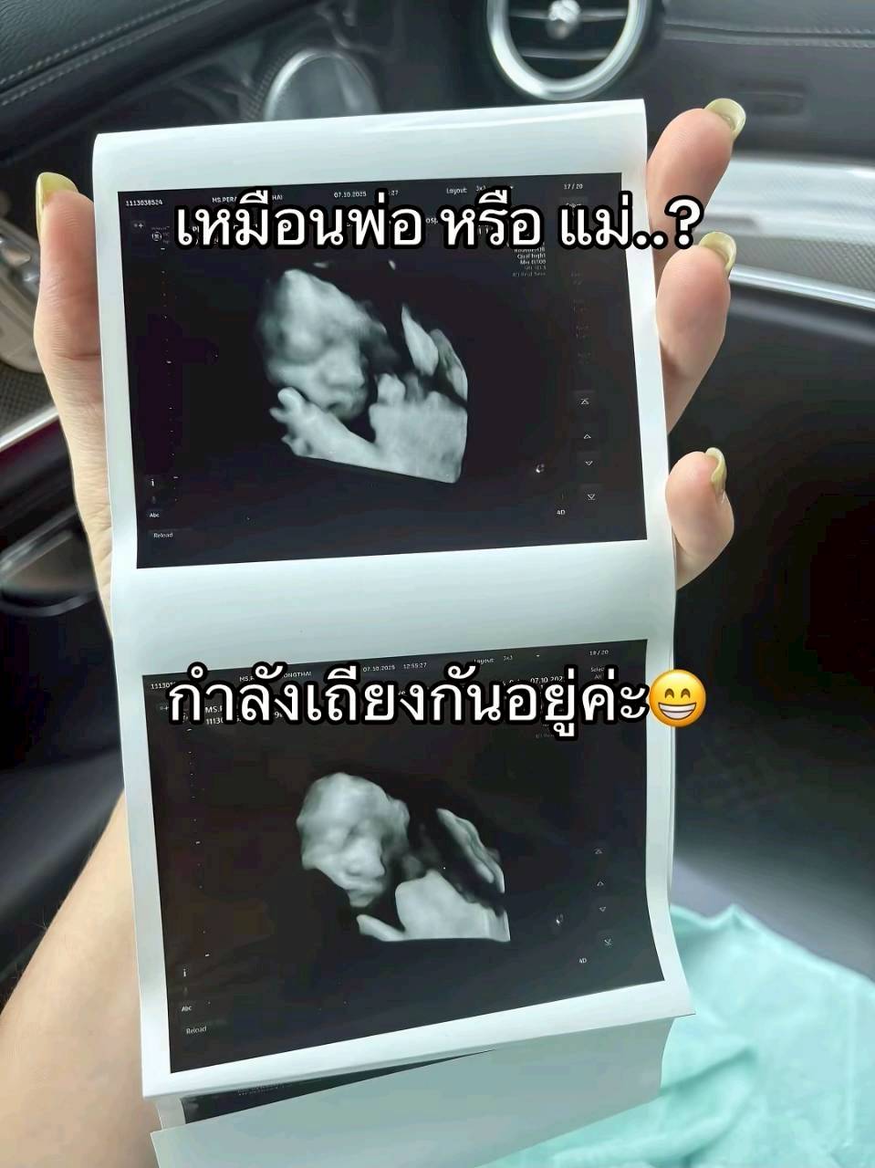 แมท ภีรนีย์