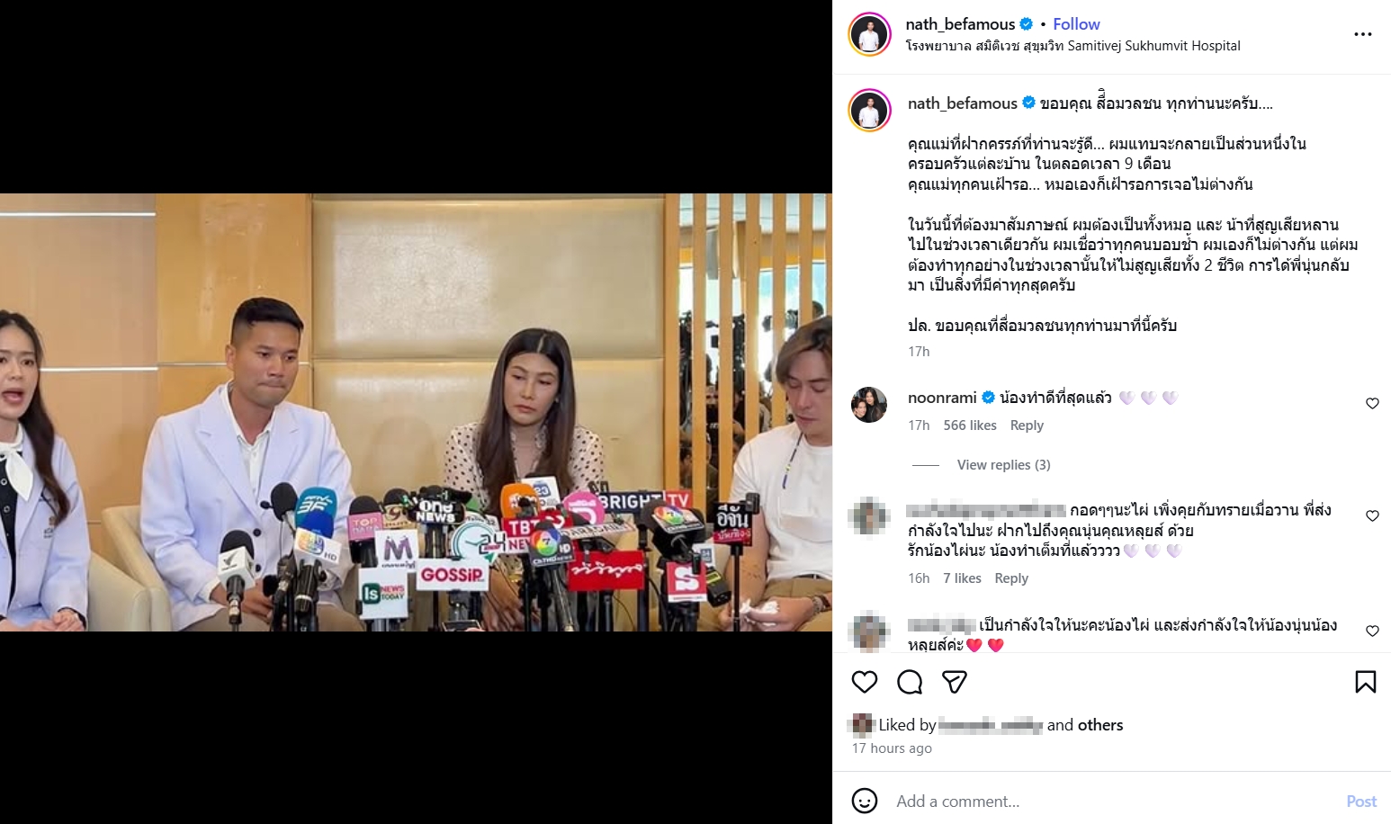 นุ่น หลุยส์