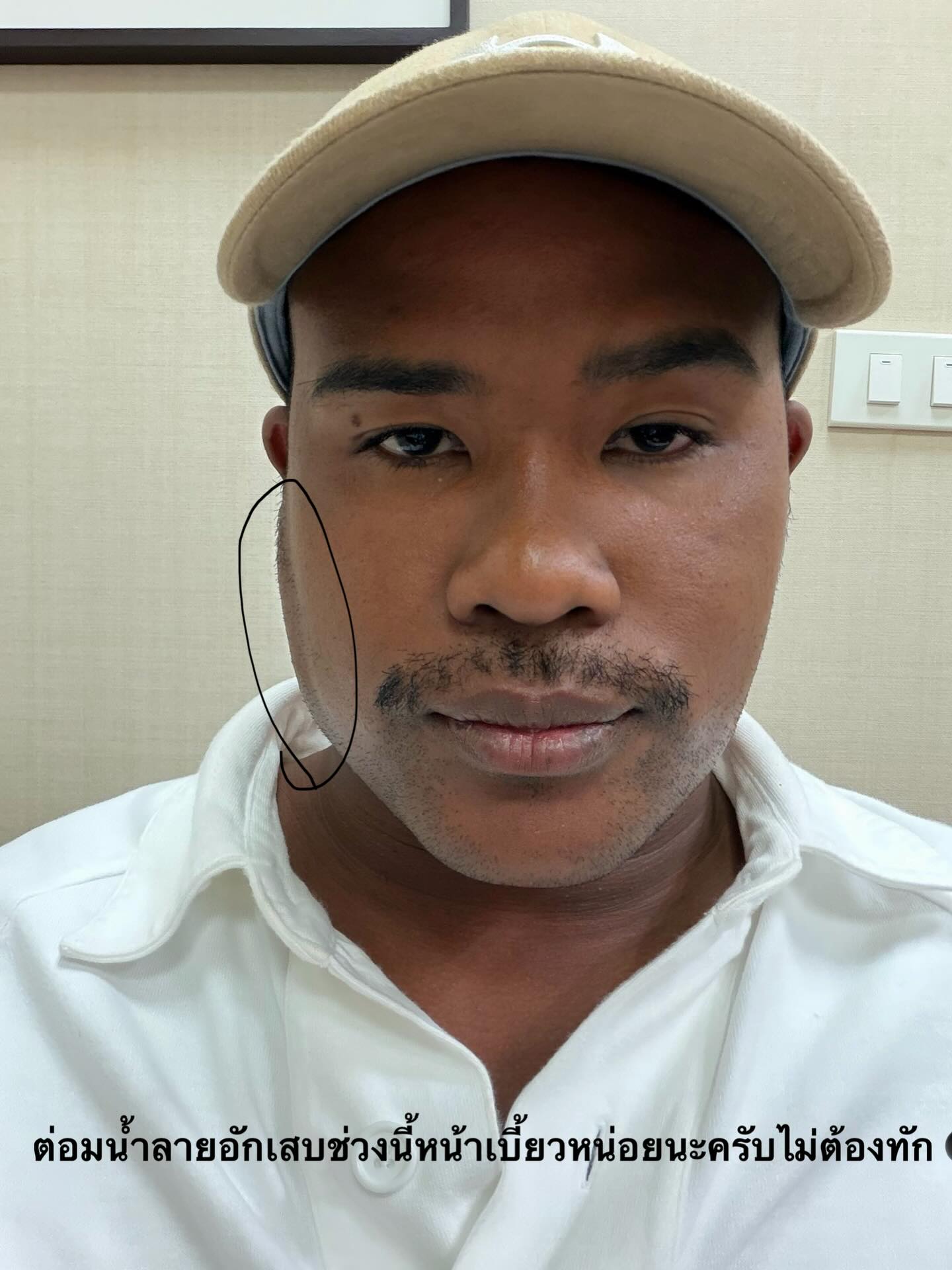 รัศมีแข ฟ้าเกื้อล้น