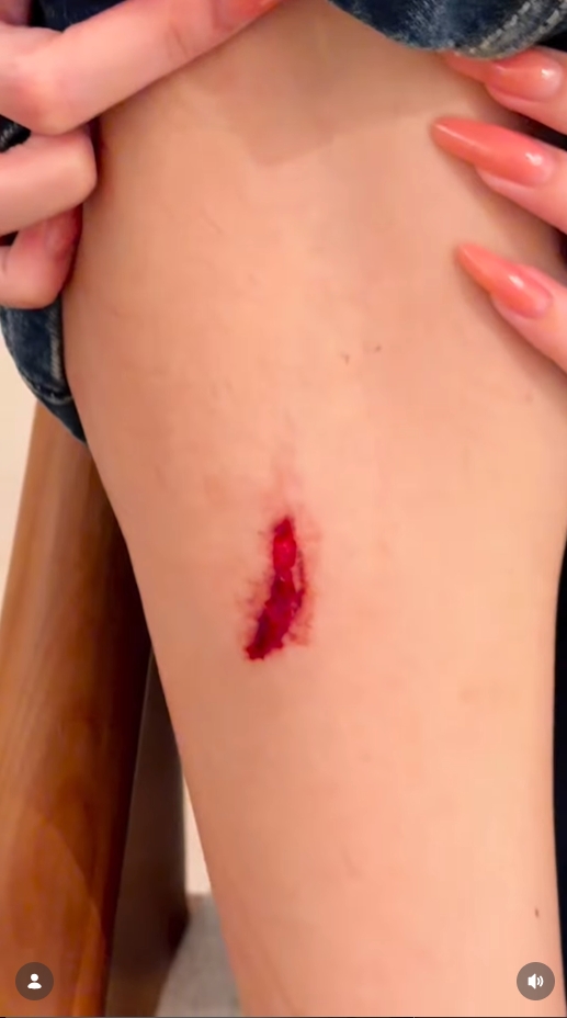 เบสท์ คำสิงห์