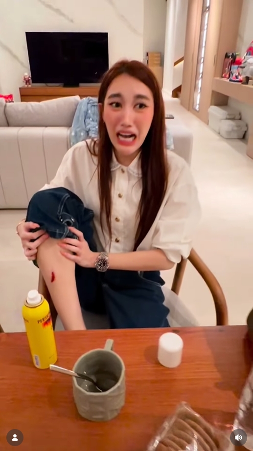 เบสท์ คำสิงห์