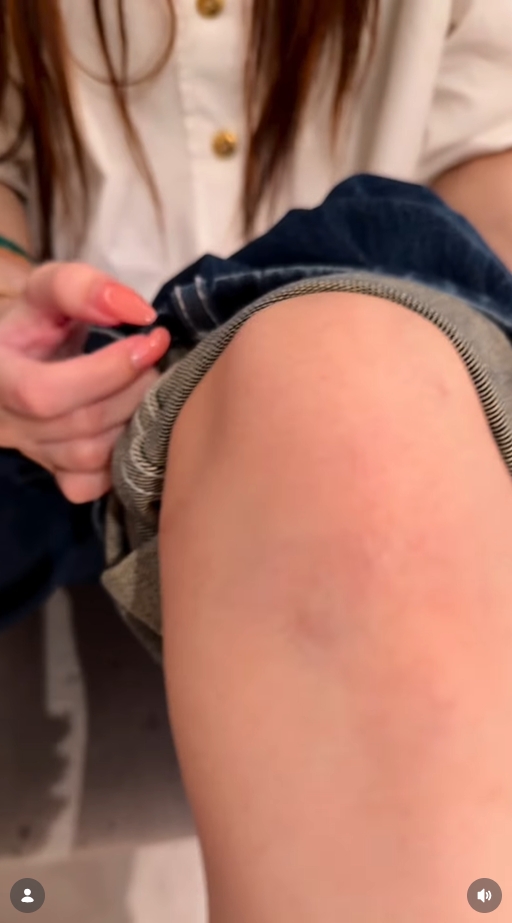 เบสท์ คำสิงห์