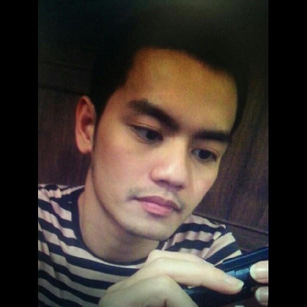 อ๊อฟ ปองศักดิ์ ศัลยกรรม