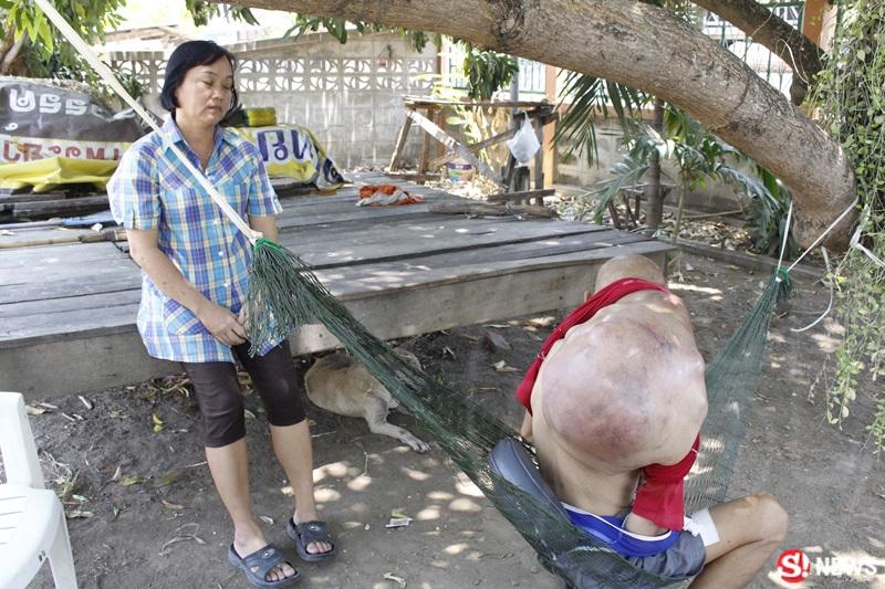 ครูเล็ก ป่วยมะเร็ง