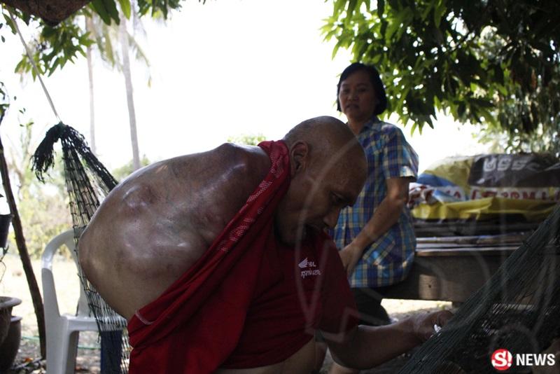 ครูเล็ก ป่วยมะเร็ง